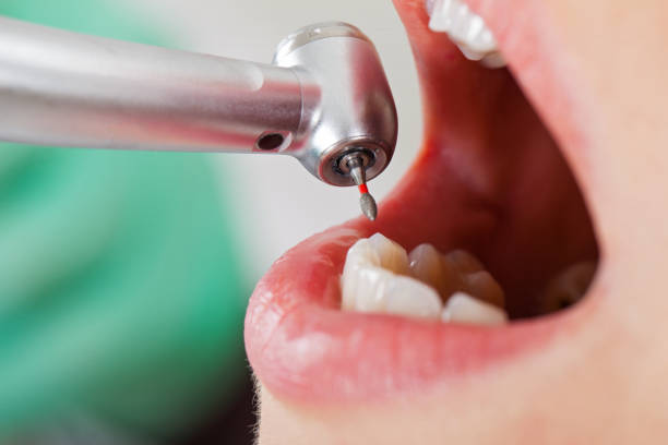 Best Cracked Tooth Emergency Dentist  in Mount Kisco, NY
